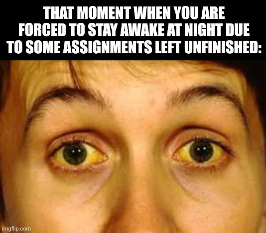 Jaundice | THAT MOMENT WHEN YOU ARE FORCED TO STAY AWAKE AT NIGHT DUE TO SOME ASSIGNMENTS LEFT UNFINISHED: | image tagged in memes,jaundice,eyes | made w/ Imgflip meme maker