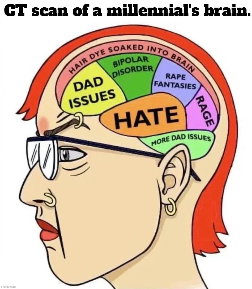CT scan of a millennial's brain. | image tagged in stupid people be like,millennials,sjw triggered,full retard tropic thunder,angry sjw,fuck your feelings | made w/ Imgflip meme maker