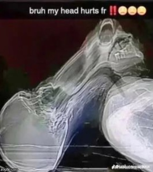 how does one even achieve such an x-ray | made w/ Imgflip meme maker