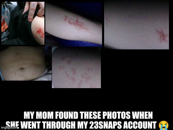 these are my healed cuts tho | MY MOM FOUND THESE PHOTOS WHEN SHE WENT THROUGH MY 23SNAPS ACCOUNT 😭 | made w/ Imgflip meme maker