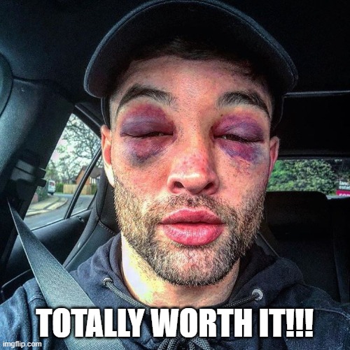 TOTALLY WORTH IT!!! | image tagged in double black eye | made w/ Imgflip meme maker