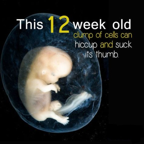 Abortion Is Murder & Nothing Less | image tagged in abortion is murder,babies,liberal logic,liberal hypocrisy,morality,genocide | made w/ Imgflip meme maker