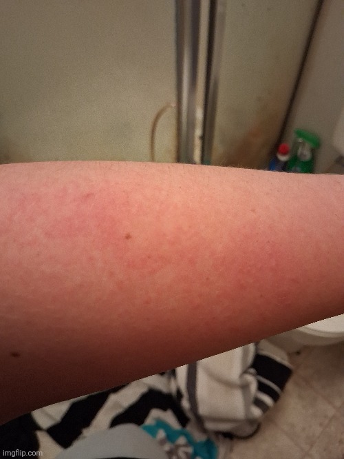 Anyone perchance know what these tiny bumps are | made w/ Imgflip meme maker