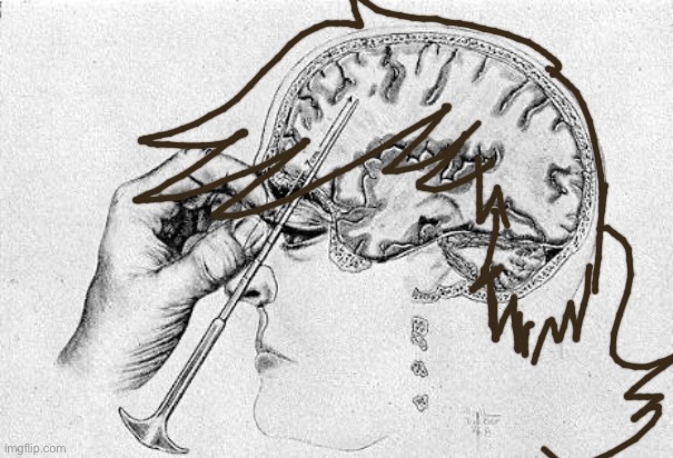Lobotomy  | image tagged in lobotomy | made w/ Imgflip meme maker
