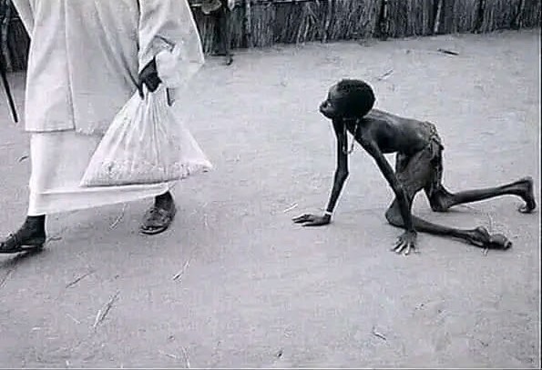 High Quality African Polio Beggar Blank Meme Template