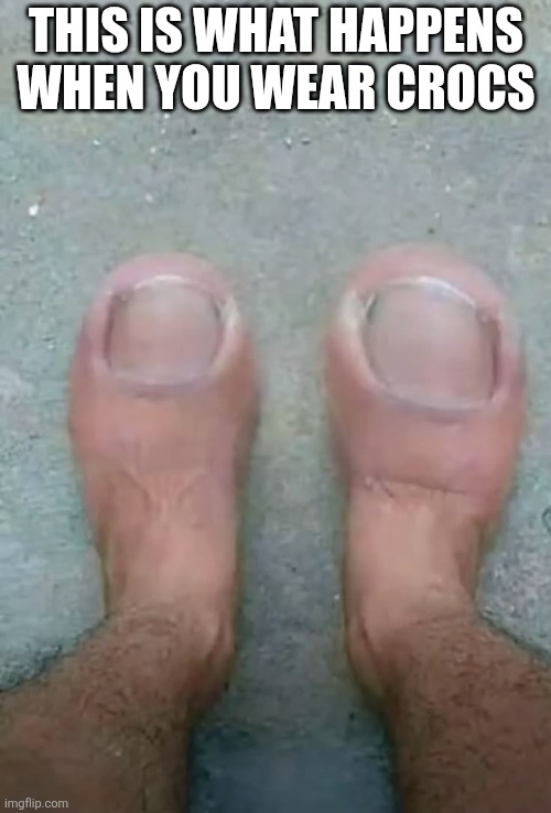This Is What Happens When You Wear Crocs | THIS IS WHAT HAPPENS WHEN YOU WEAR CROCS | image tagged in chrisjoines1 | made w/ Imgflip meme maker