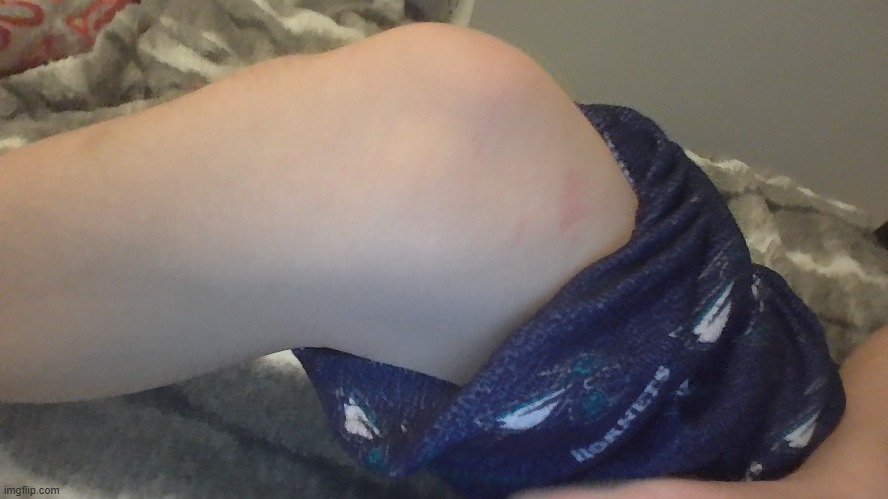 knee reveal again (posting this while im at at school) | image tagged in hi | made w/ Imgflip meme maker