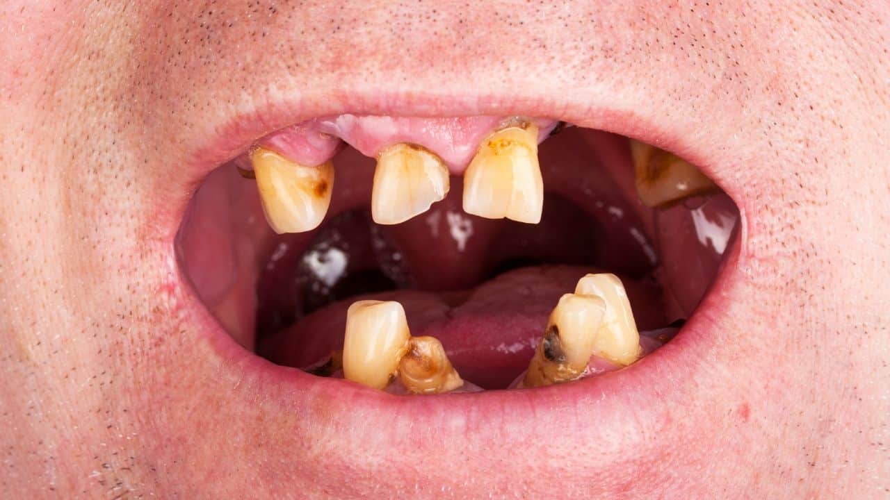 methmouth Blank Meme Template