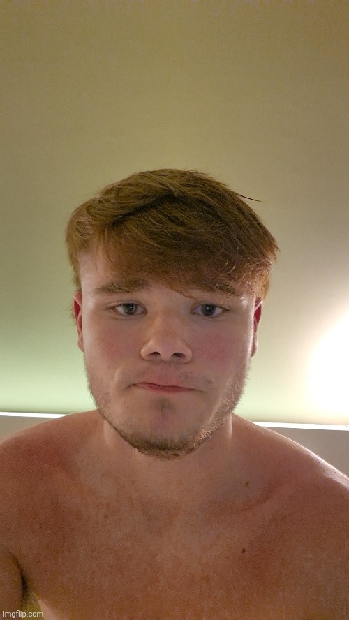 I'm so sunburnt </3 | made w/ Imgflip meme maker