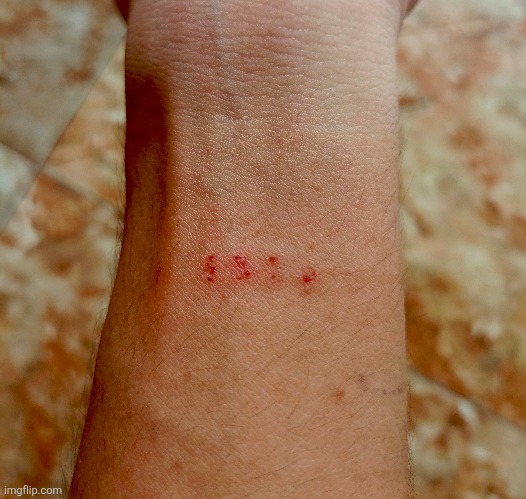 Love it when my smartwatch rip my skin (just realized how hairy i am) | image tagged in memes,photo | made w/ Imgflip meme maker
