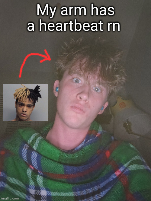 Imma kms | My arm has a heartbeat rn | image tagged in arm is stupid | made w/ Imgflip meme maker