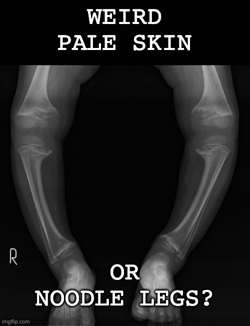WEIRD PALE SKIN OR NOODLE LEGS? | made w/ Imgflip meme maker