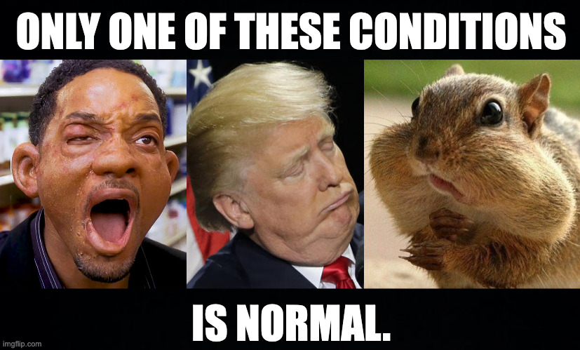Imgflip should have a TV channel that just rotates thru the day's memes. | ONLY ONE OF THESE CONDITIONS; IS NORMAL. | image tagged in trump watch,hitch allergic,squirrel cheeks full,memes | made w/ Imgflip meme maker