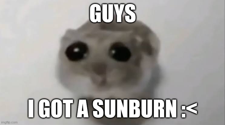 :< | GUYS; I GOT A SUNBURN :< | image tagged in sad hamster | made w/ Imgflip meme maker