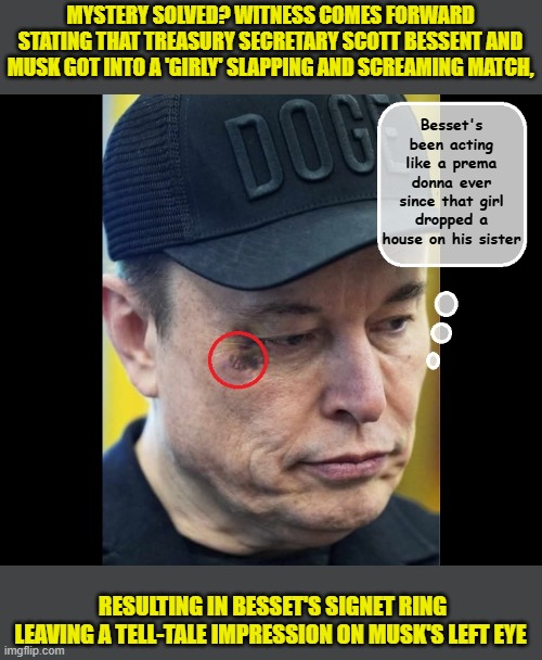 BREAKING: White House infighting exposed by billionaire's pinky ring... | MYSTERY SOLVED? WITNESS COMES FORWARD STATING THAT TREASURY SECRETARY SCOTT BESSENT AND MUSK GOT INTO A 'GIRLY' SLAPPING AND SCREAMING MATCH, Besset's been acting like a prema donna ever since that girl dropped a house on his sister; RESULTING IN BESSET'S SIGNET RING LEAVING A TELL-TALE IMPRESSION ON MUSK'S LEFT EYE | image tagged in impeach trump,donald trump memes,government corruption,trump is a moron,elon musk | made w/ Imgflip meme maker
