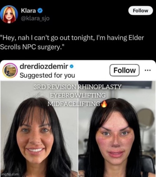 Elder Scrolls NPC surgery | made w/ Imgflip meme maker