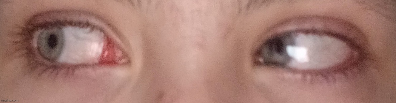 Why is my eye doing this (look in comments) | made w/ Imgflip meme maker