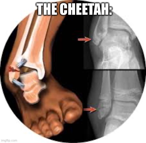 THE CHEETAH: | image tagged in broken ankle | made w/ Imgflip meme maker
