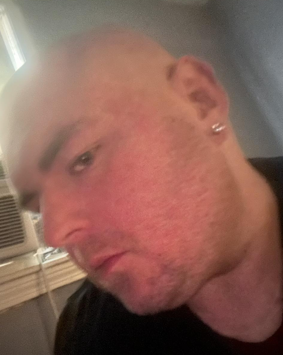 Bald Blank Meme Template