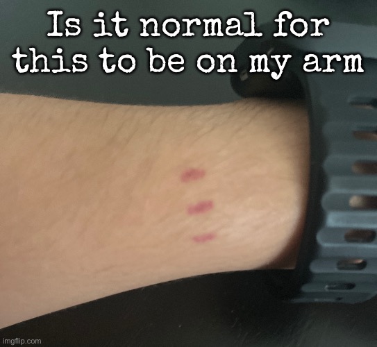 I belive not | Is it normal for this to be on my arm | image tagged in msmg | made w/ Imgflip meme maker