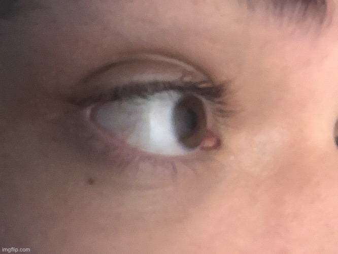 eyes | image tagged in eyes | made w/ Imgflip meme maker