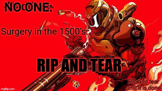 Rip and tear | NO ONE:; Surgery in the 1500's:; RIP AND TEAR | image tagged in rip and tear | made w/ Imgflip meme maker