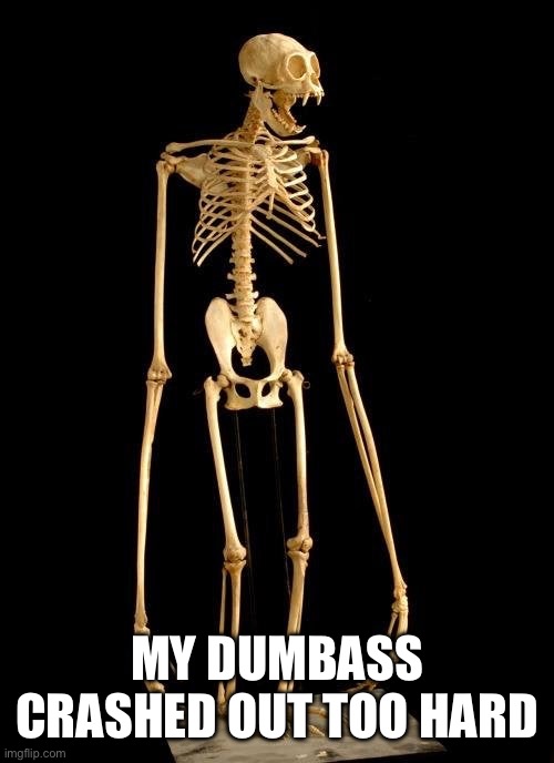 Ape skeleton | MY DUMBASS CRASHED OUT TOO HARD | image tagged in ape skeleton | made w/ Imgflip meme maker
