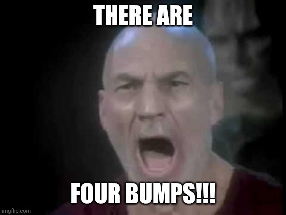 Picard Four Lights | THERE ARE; FOUR BUMPS!!! | image tagged in picard four lights | made w/ Imgflip meme maker