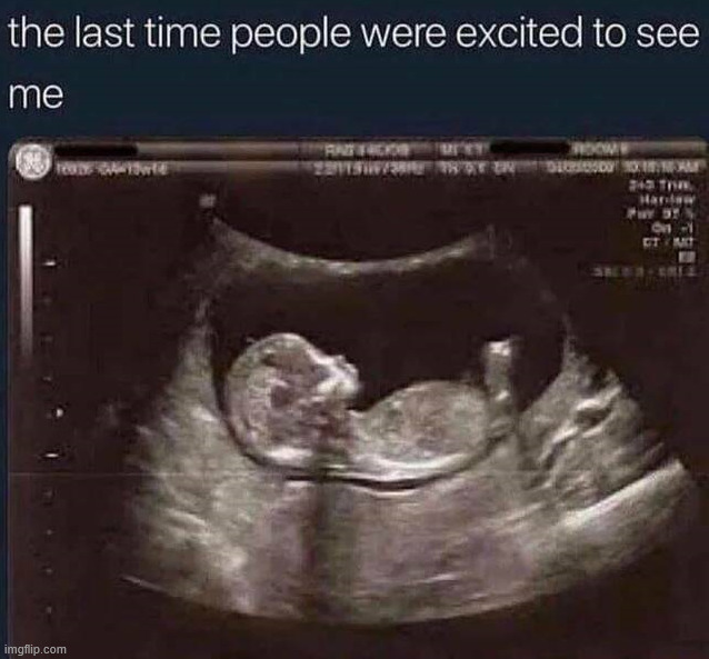 Even then I don't know they are | image tagged in overload | made w/ Imgflip meme maker