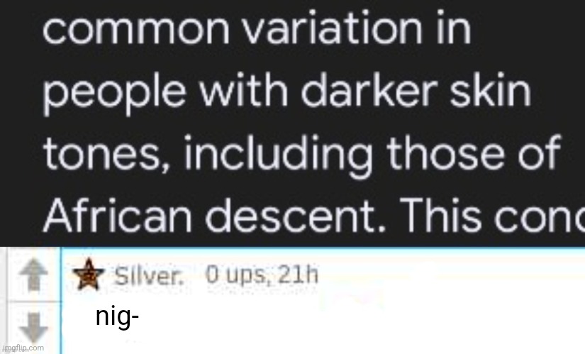 nig- | image tagged in nigg- | made w/ Imgflip meme maker