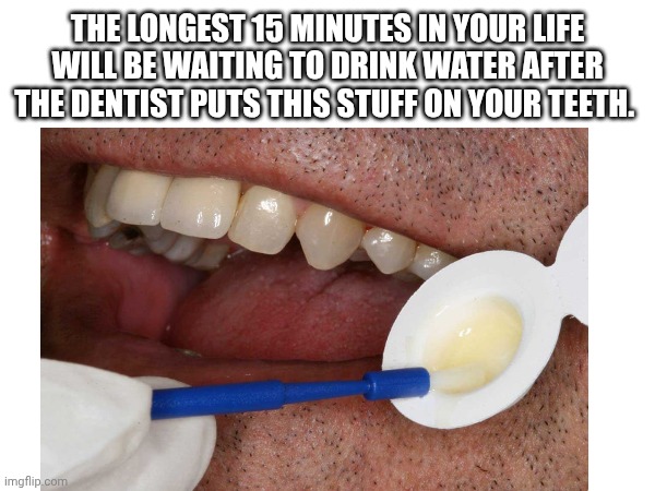 The longest 15 minutes ever | THE LONGEST 15 MINUTES IN YOUR LIFE WILL BE WAITING TO DRINK WATER AFTER THE DENTIST PUTS THIS STUFF ON YOUR TEETH. | image tagged in dentist,relatable,teeth,water | made w/ Imgflip meme maker