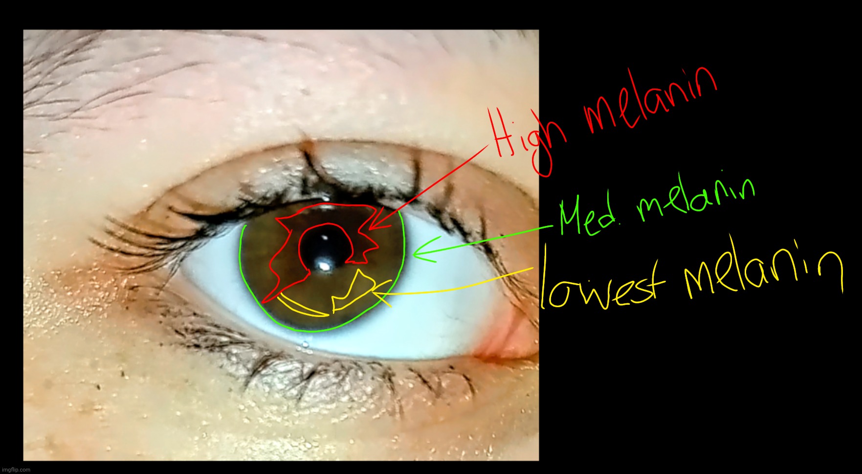 Picture diagram of central heterochromia (ft. my eye) | made w/ Imgflip meme maker