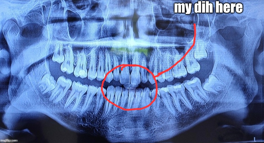 my dih here | made w/ Imgflip meme maker