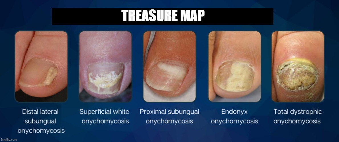 TREASURE MAP | made w/ Imgflip meme maker