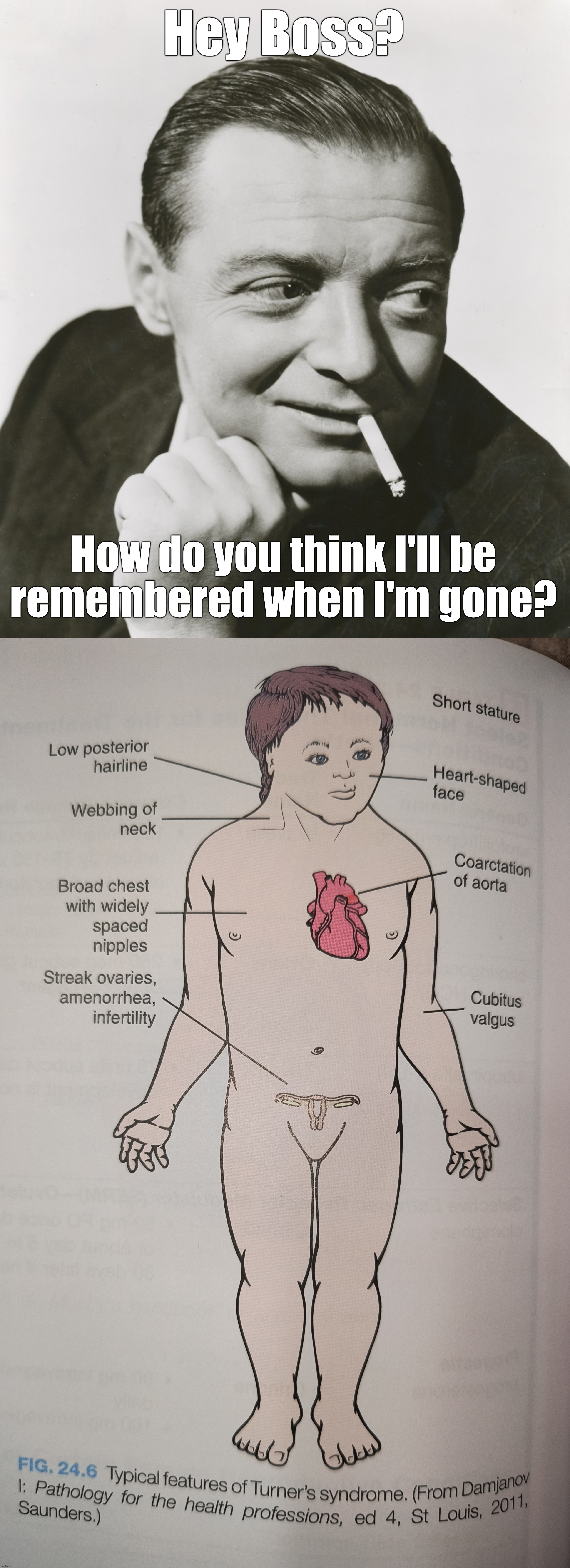 Turner's Syndrome | Hey Boss? How do you think I'll be
remembered when I'm gone? | image tagged in peter lorre | made w/ Imgflip meme maker