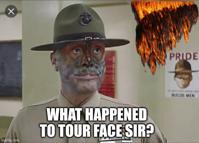 Napalm sticks to kids | WHAT HAPPENED TO TOUR FACE SIR? | image tagged in i love the smell of napalm in the morning,nuclear bomb,iran,nuclear war | made w/ Imgflip meme maker