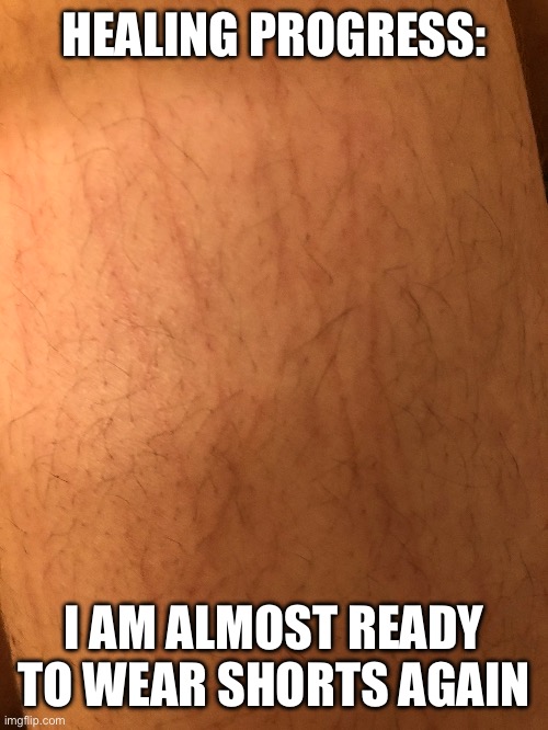 Yaaaaay | HEALING PROGRESS:; I AM ALMOST READY TO WEAR SHORTS AGAIN | image tagged in yippee | made w/ Imgflip meme maker