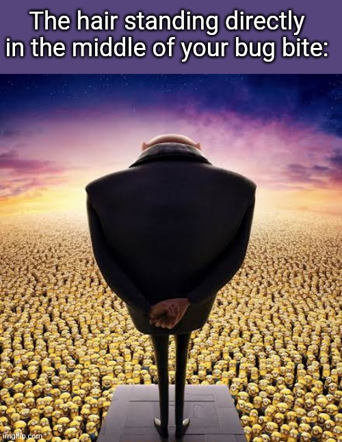 guys i have bad news | The hair standing directly in the middle of your bug bite: | image tagged in guys i have bad news | made w/ Imgflip meme maker