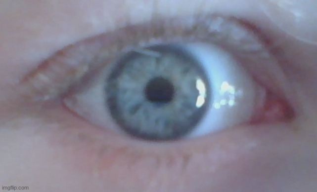 why is my pupil like that | made w/ Imgflip meme maker