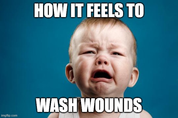 ouch it hurts bo-hooooo | HOW IT FEELS TO; WASH WOUNDS | image tagged in baby crying | made w/ Imgflip meme maker