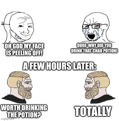 DRINKING CHAD POTION AT 3AM!!!! | OH GOD MY FACE IS PEELING OFF! DUDE  WHY DID YOU DRINK THAT CHAD POTION! A FEW HOURS LATER:; TOTALLY; WORTH DRINKING THE POTION? | image tagged in chad we know,dumb | made w/ Imgflip meme maker