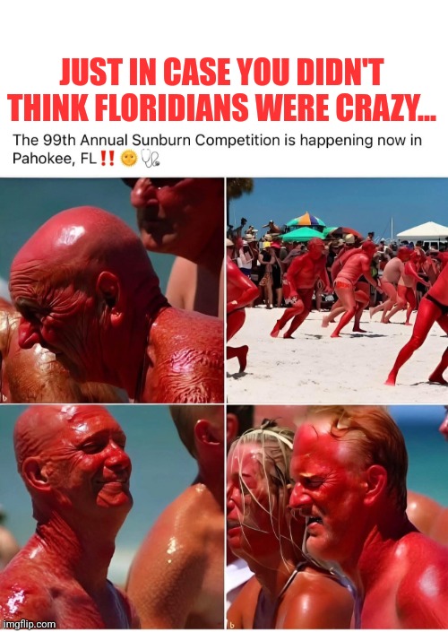 That's gonna hurt... | JUST IN CASE YOU DIDN'T THINK FLORIDIANS WERE CRAZY... | image tagged in bad,sunburn,florida man,burning,red,bad ideas | made w/ Imgflip meme maker