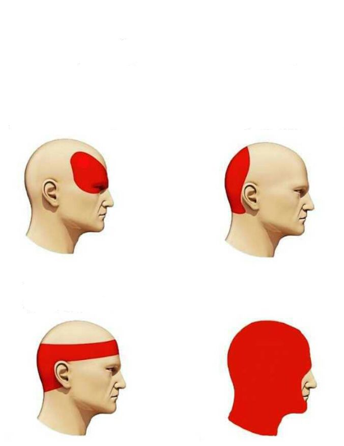 High Quality Headache Blank Meme Template
