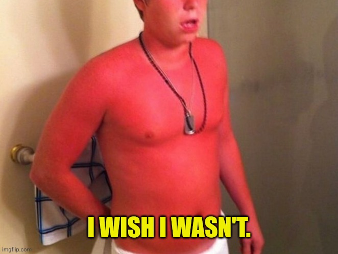Extreme sunburn | I WISH I WASN'T. | image tagged in extreme sunburn | made w/ Imgflip meme maker