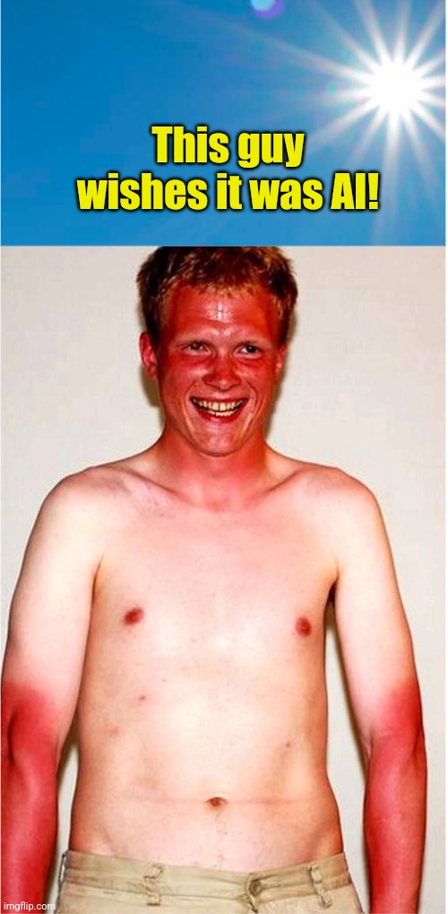 Sun & Sunburn | This guy wishes it was AI! | image tagged in sun sunburn | made w/ Imgflip meme maker