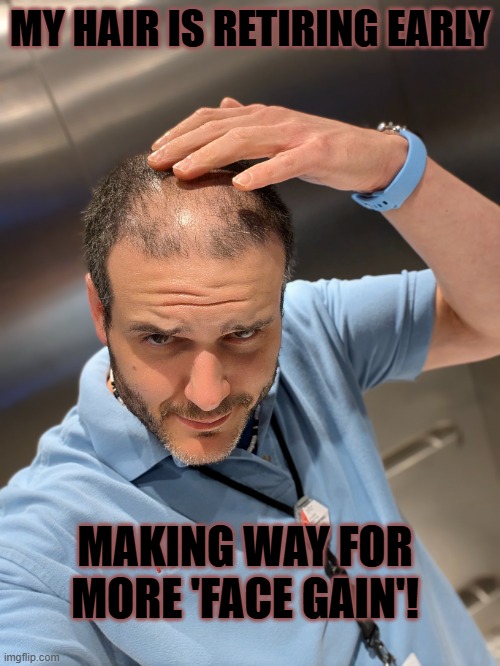 Bald Spot | MY HAIR IS RETIRING EARLY; MAKING WAY FOR MORE 'FACE GAIN'! | image tagged in bald,chinese,funny | made w/ Imgflip meme maker