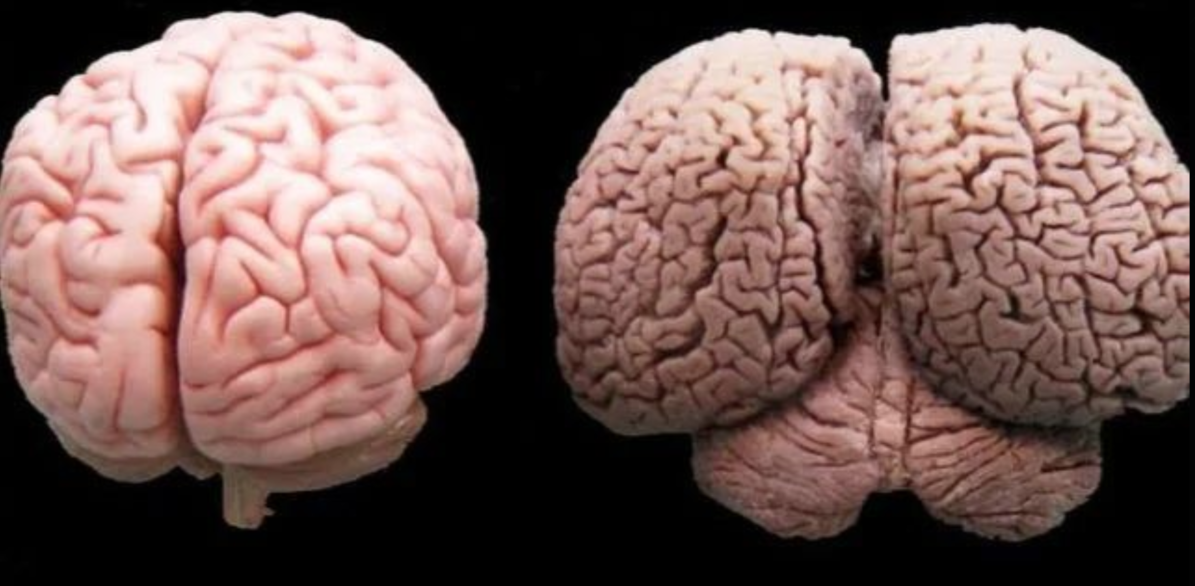 brain Blank Meme Template