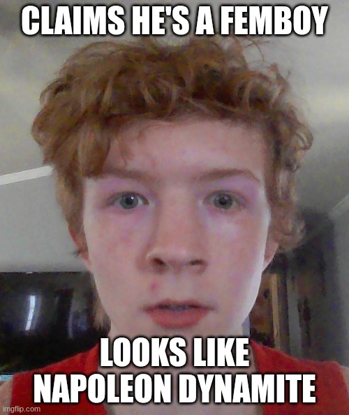 street rat ptsd | CLAIMS HE'S A FEMBOY; LOOKS LIKE NAPOLEON DYNAMITE | image tagged in street rat ptsd | made w/ Imgflip meme maker