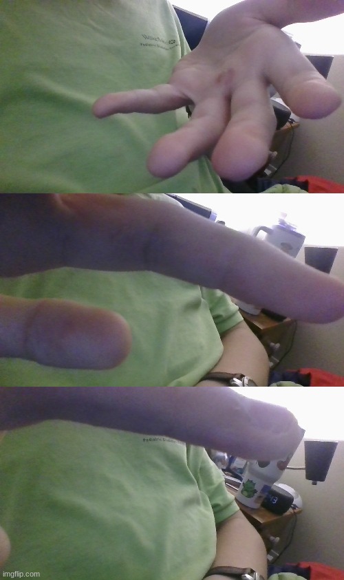 Went golfing. Now I know why they wear gloves. (Last two images are a bit blurry) | made w/ Imgflip meme maker