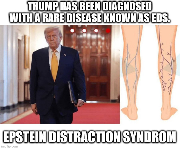 TRUMP HAS BEEN DIAGNOSED WITH A RARE DISEASE KNOWN AS EDS. EPSTEIN DISTRACTION SYNDROM | made w/ Imgflip meme maker